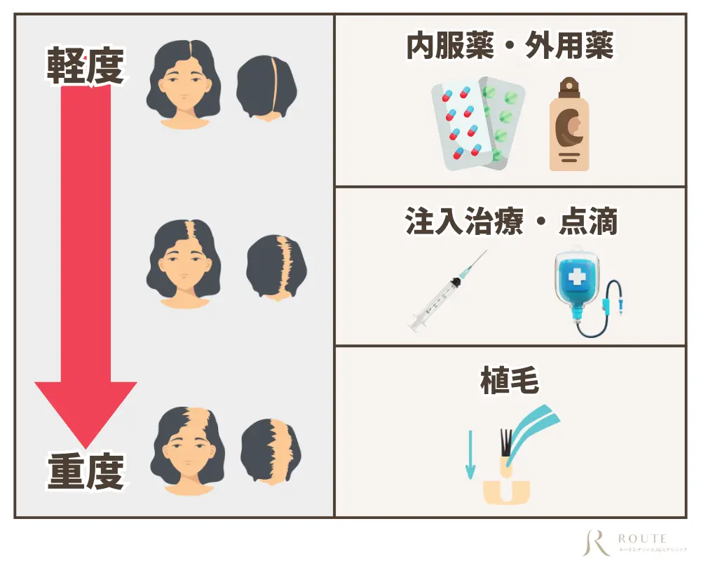 女性の薄毛治療方法
