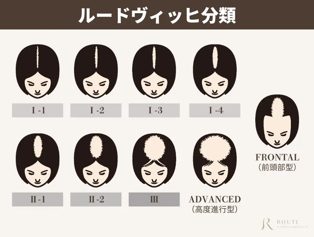 ルードヴィッヒ分類