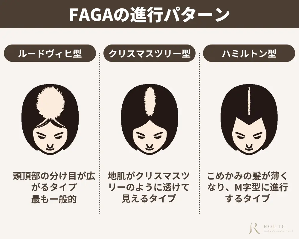FAGAの進行パターン