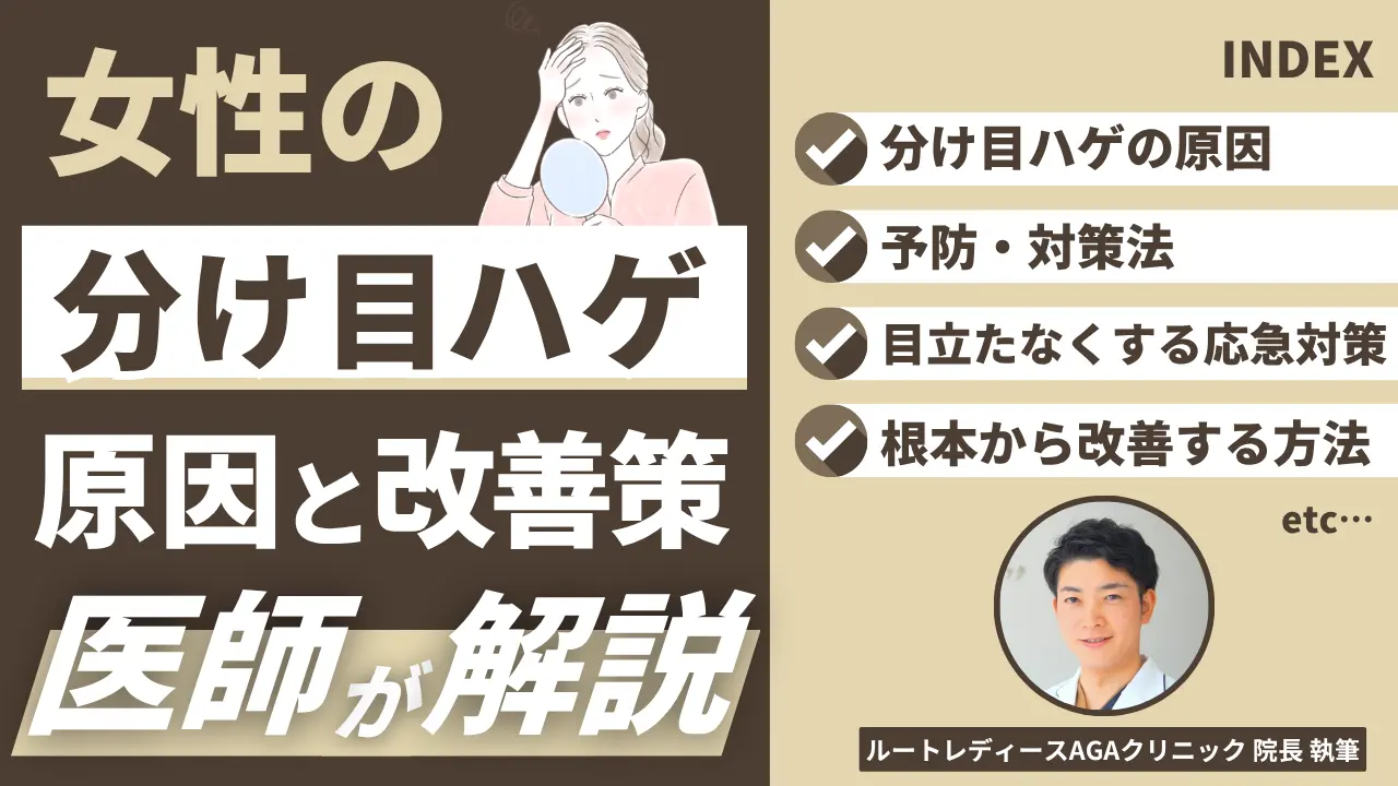 女性の分け目ハゲ原因と改善法を医師が解説