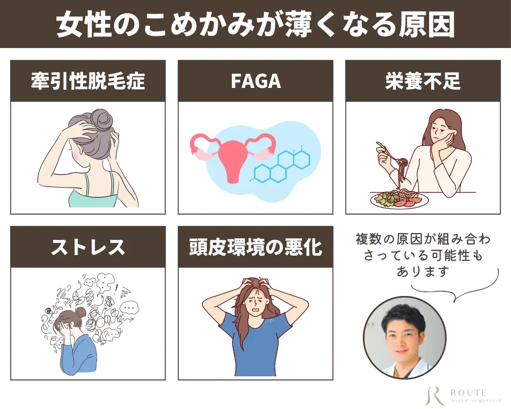 女性のこめかみが薄くなる原因